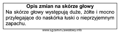 Przedstawiony opis dotyczy zmian na skórze głowy, charakterystycznych 