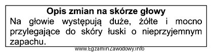 Przedstawiony opis dotyczy zmian na skórze głowy, charakterystycznych 