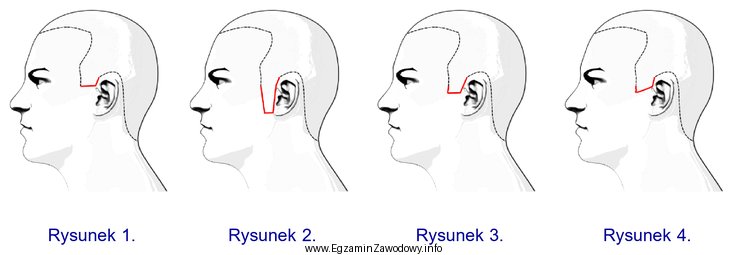 Na którym rysunku przedstawiona jest linia konturowa baków, 