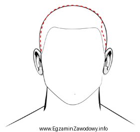Deformacją głowy, oznaczoną na rysunku czerwoną przerywaną linią, jest