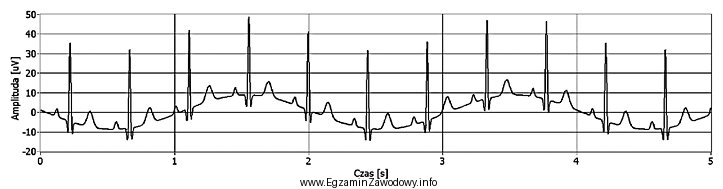 Podczas testowania elektrokardiografu otrzymano przedstawiony przebieg. Na jego podstawie stwierdzono, 