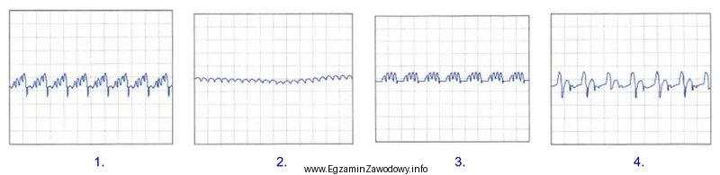 Który z oscylogramów przedstawionych na rysunkach, odczytany z 