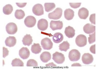 Przedstawione na ilustracji pierwotniaki bytujące w erytrocytach świadczą 