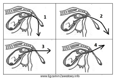 Który kierunek wyciągania płodu krowy przy uż