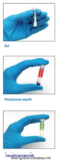 Ilustracje wymazówki umieszczonej w fiolce z odczynnikiem przedstawiają test