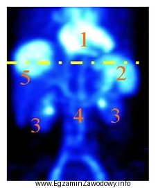 Który narząd na obrazie scyntygrafii znakowanej erytrocytami zaznaczono 