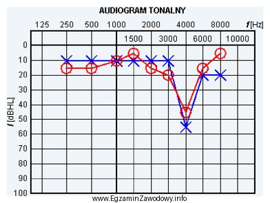 Wynik badania słuchu metodą audiometrii tonalnej wskazuje na